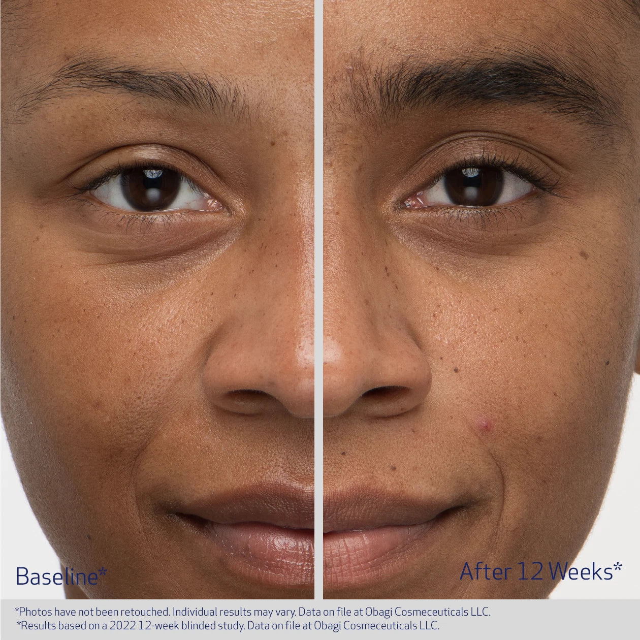 EYEBROW BOOSTING SERUM - Image 3