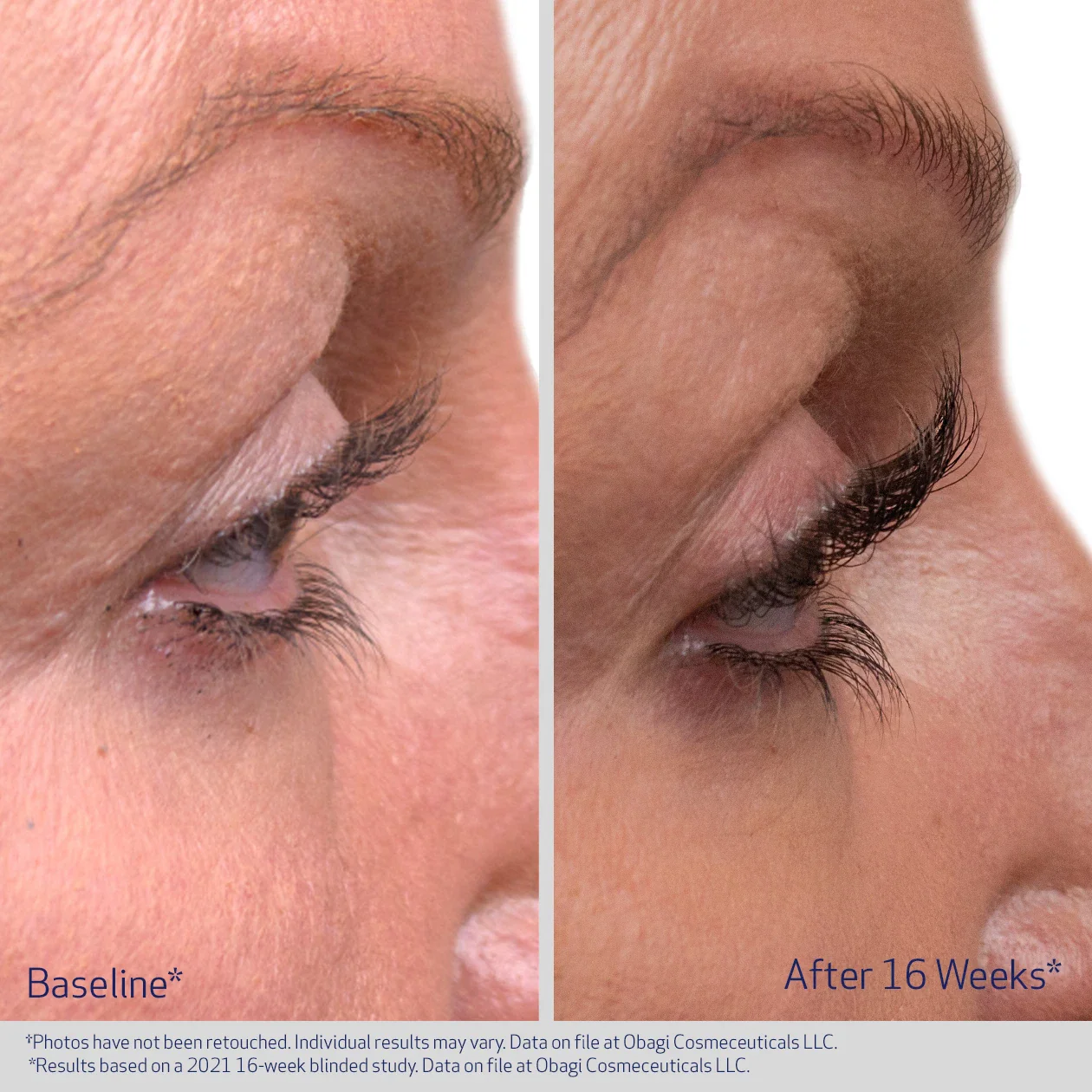 EYELASH ENHANCING SERUM - Image 3